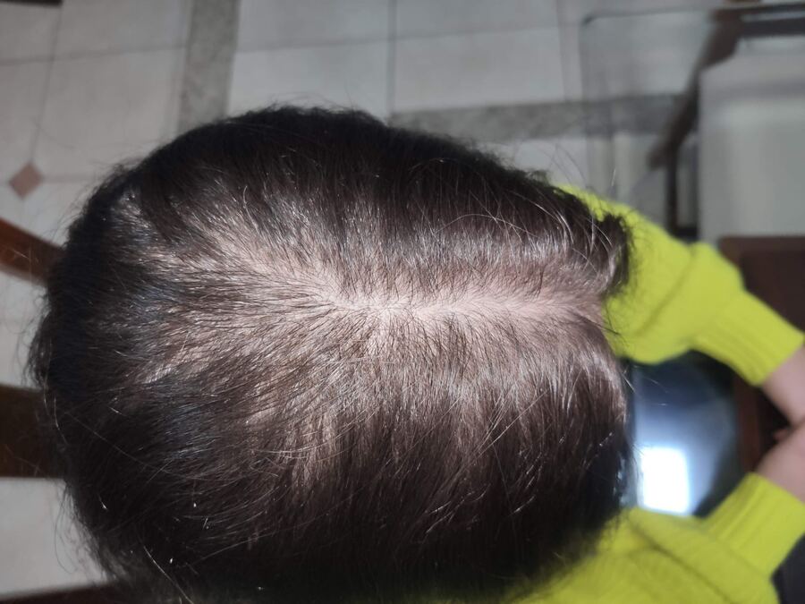 Tratamento capilar: antes