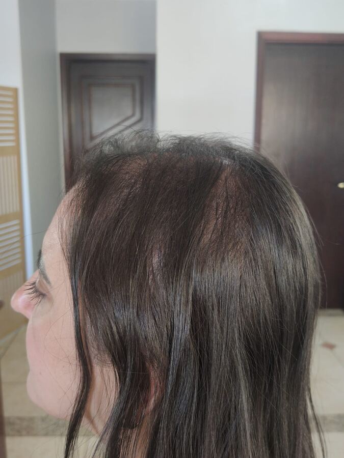 Tratamento capilar: antes