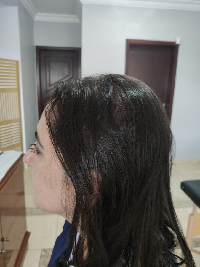Tratamento capilar: depois