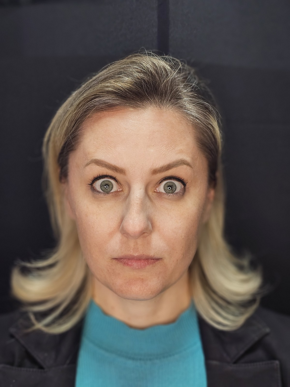 Estética facial: depois