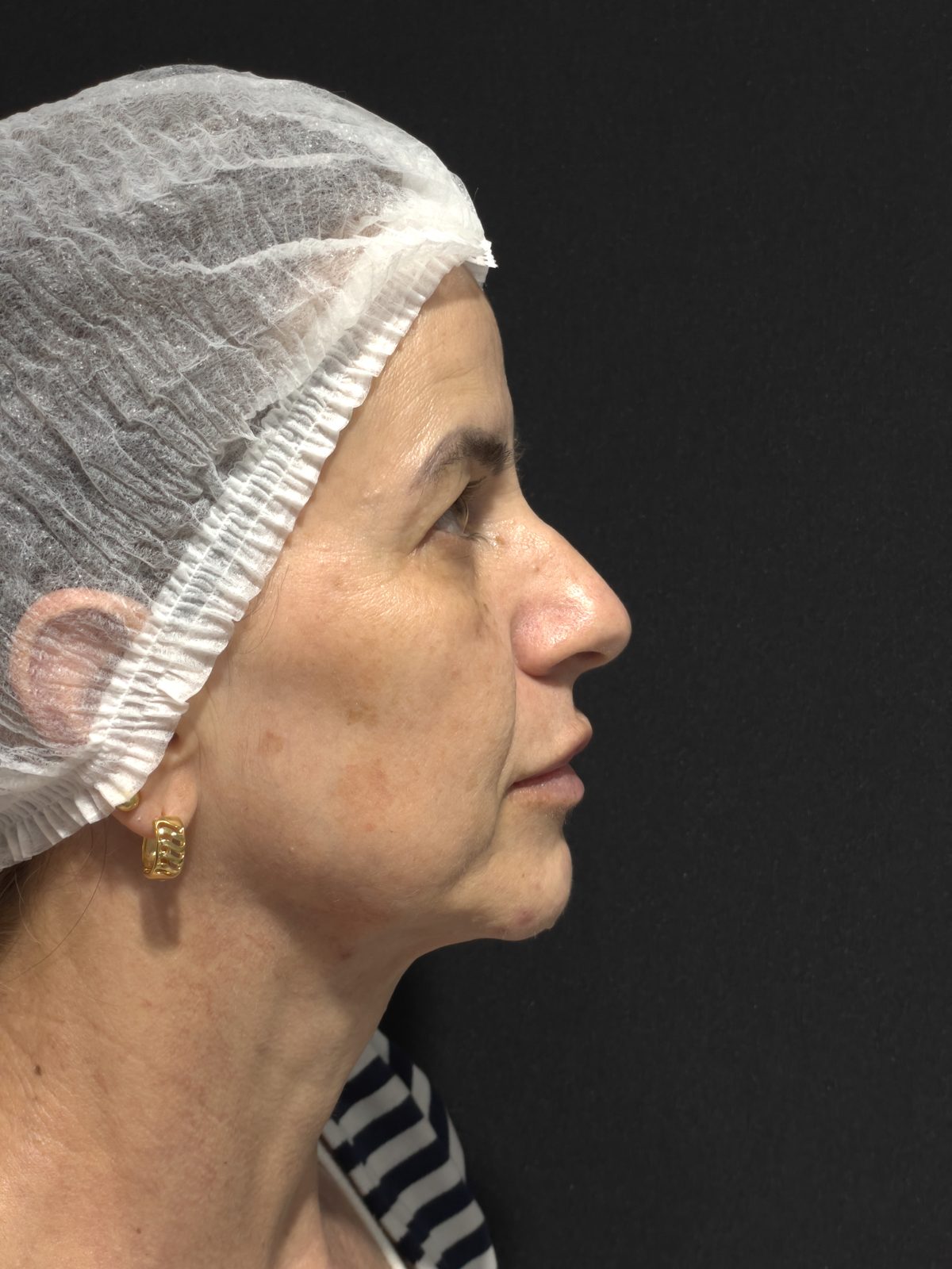 Estética facial: antes