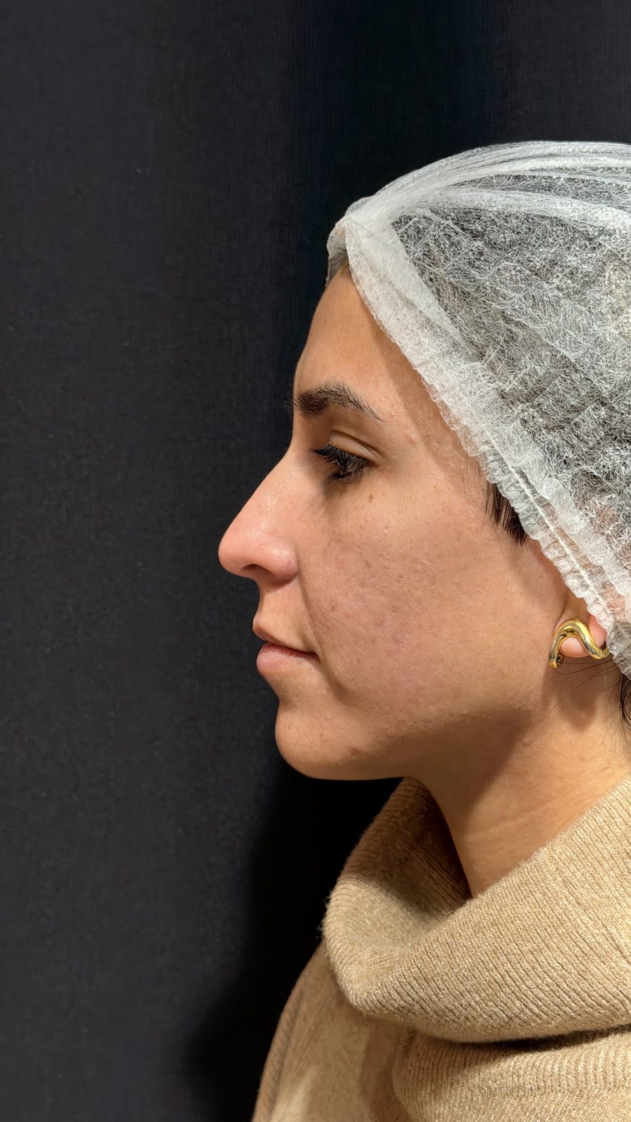 Estética facial: antes