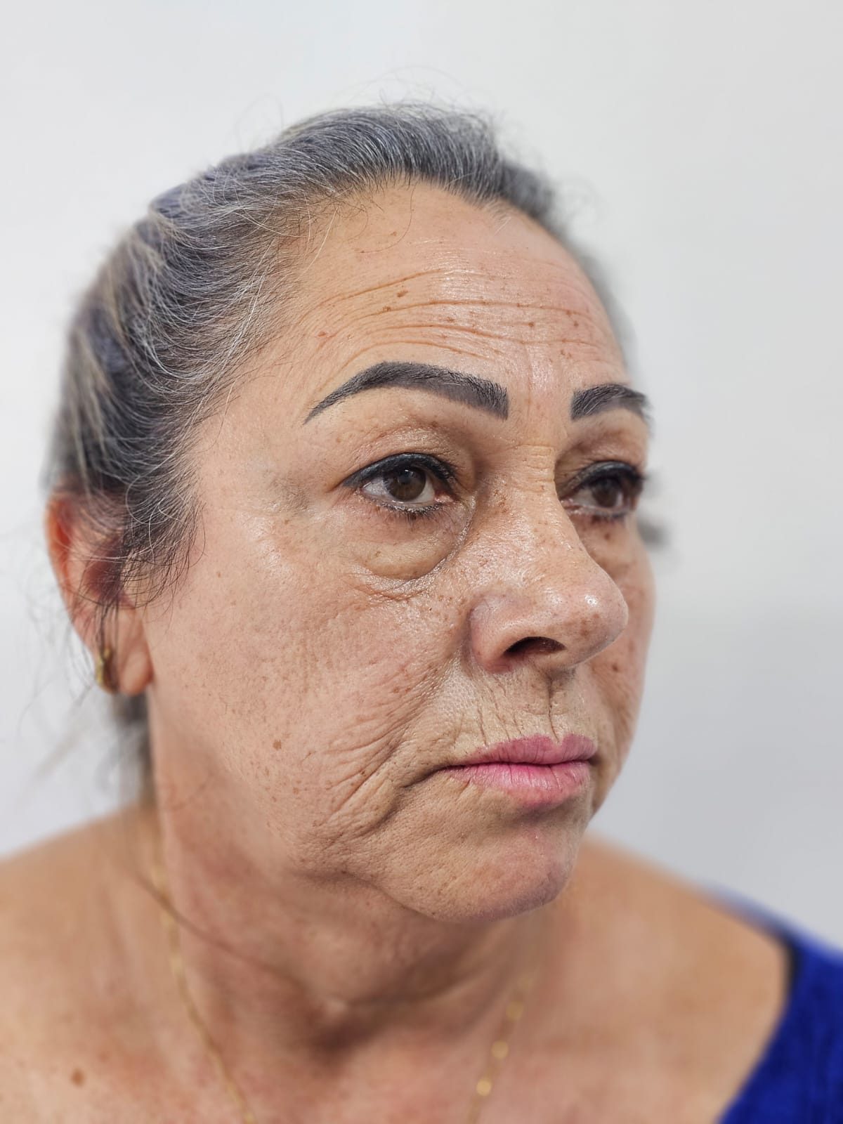 Estética facial: antes