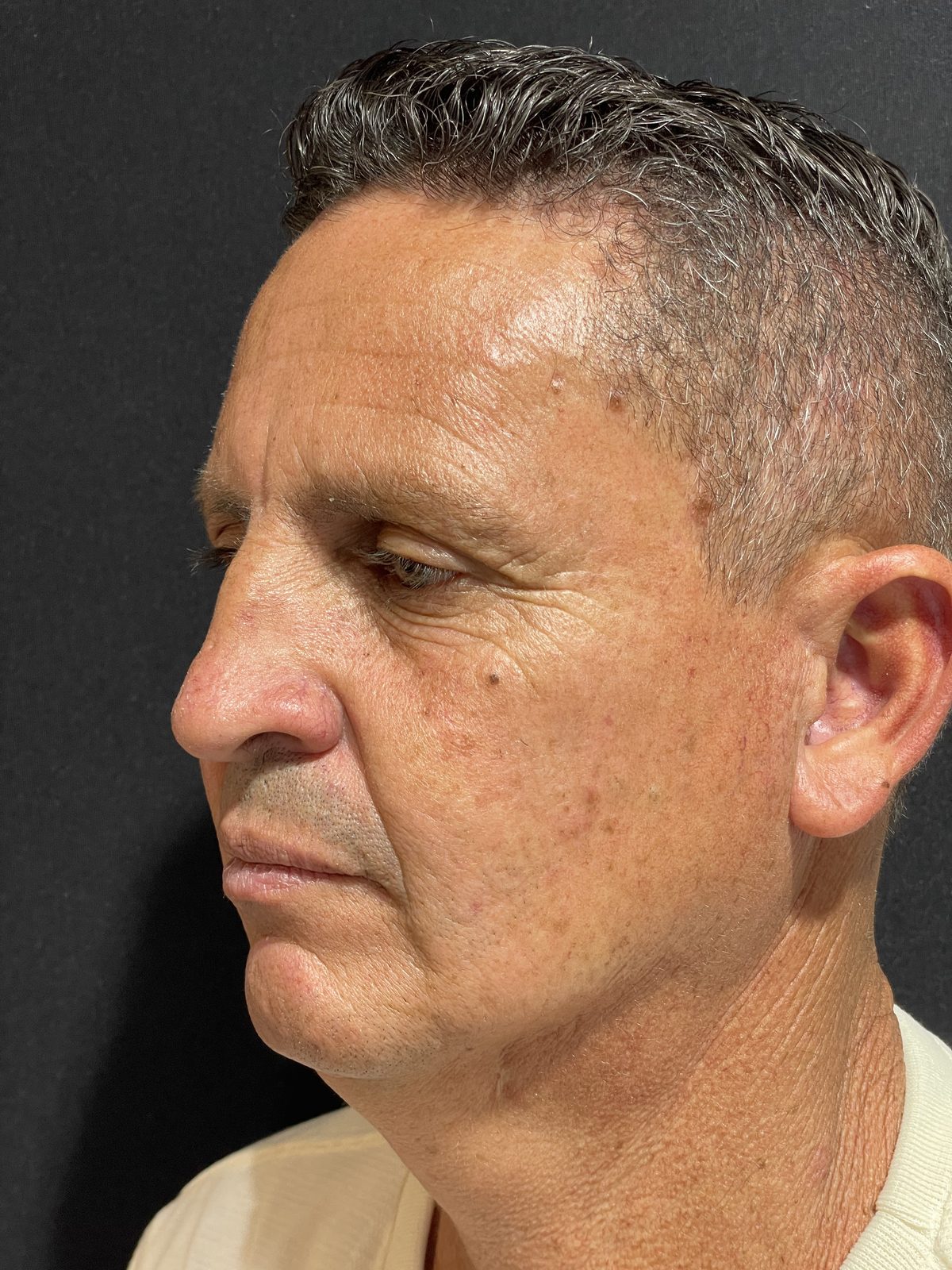 Estética facial: antes