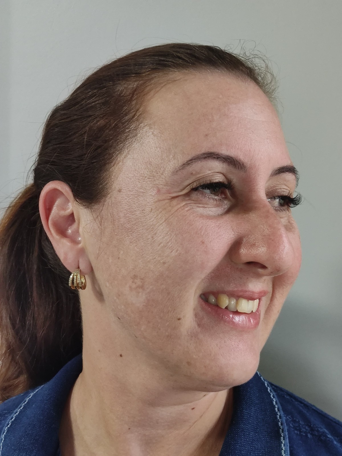 Estética facial: antes